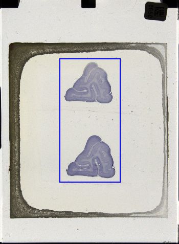 Media type: image; Special Collections 3043   shows specimen_part histological serial section;
